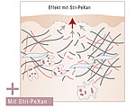 Stri-PeXan - Treatment